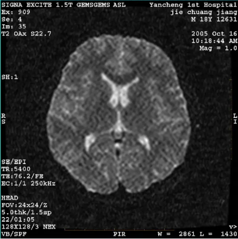 ARTIFAK WI/Fiesta Gambar Piksel Putih